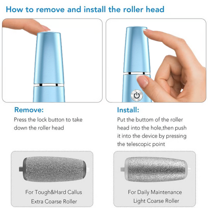 ??Hot Sale - 50% OFF??Electric Feet Callus Remover?