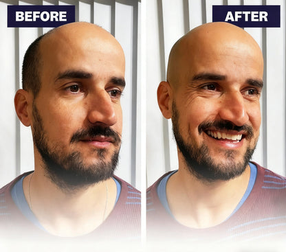 🔥Effortless Head Shaving: Must-Have Shaver For Bald Guys🔥