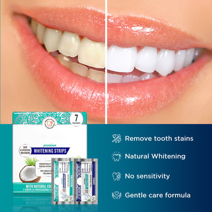 ✨Get sparkling white teeth with these teeth whitening strips💥(Five courses of treatment are effective)